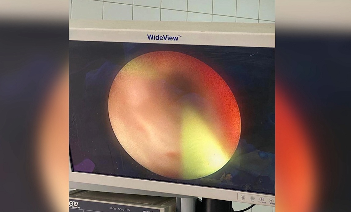 В областную больницу им. Бурденко поступило новое оборудование для проведения урологических  операций