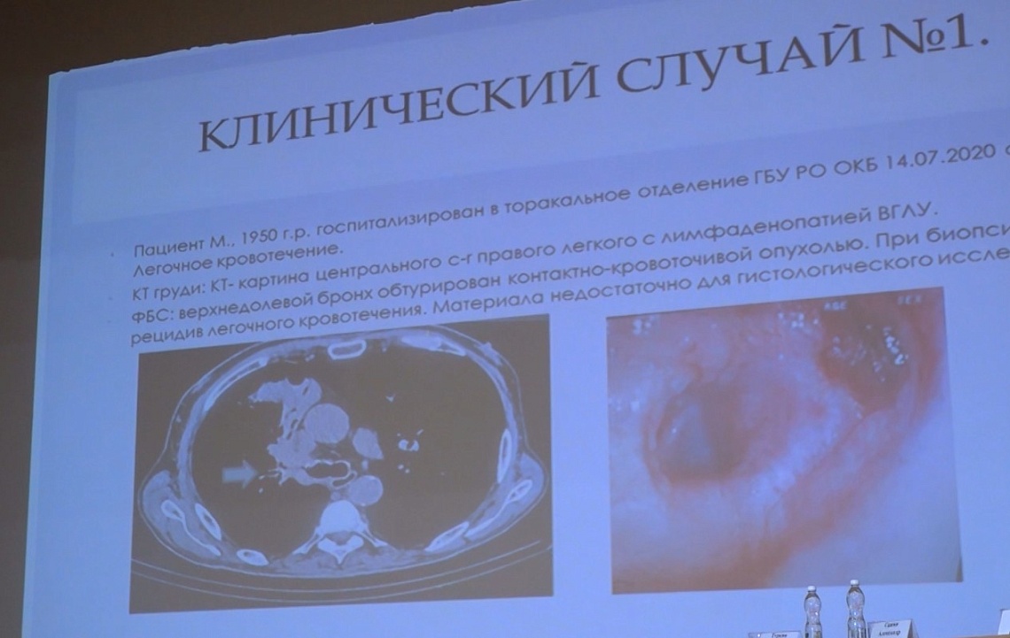 В эти дни Пенза впервые принимает межрегиональную конференцию врачей-онкологов