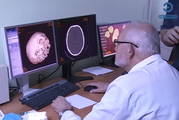 В Пензенской области начали применять 3D-печать в операциях на черепе